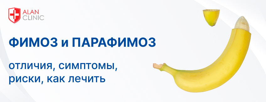 Фимоз и парафимоз: отличия, симптомы, риски