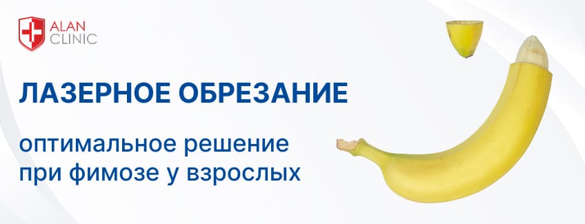 Лазерное обрезание при фимозе: современная операция без боли и кровопотерь