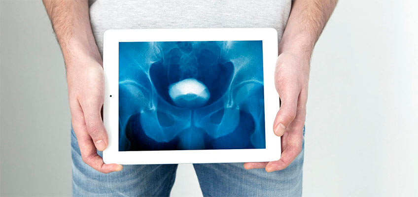 Андролог - заболевания Андролог - заболевания