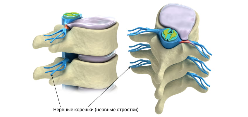 Заболевания в неврологии – болезни нервов