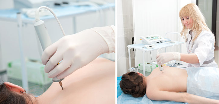 Лазерная инфракрасная рефлексотерапия